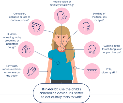 How to spot the signs of anaphylaxis