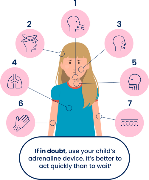 How to spot the signs of anaphylaxis